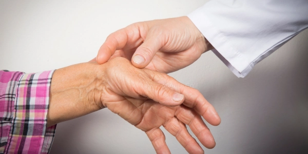 Rheumatoid Arthritis