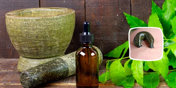 Ayurvedic Treatment for Psoriasis
