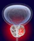 Prostate