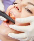 Root Canal treatment