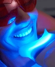 Teeth whitening