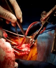 Vascular Surgery